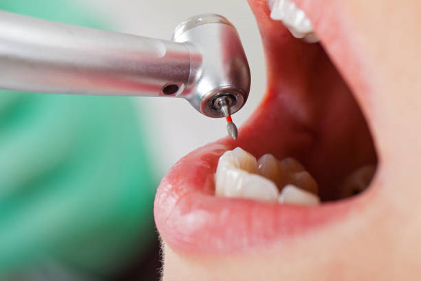 Best Weekend Emergency Dental Services in Salt Creek Commons, IN